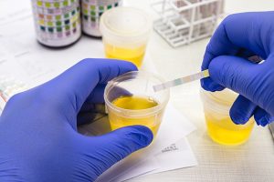 Esame delle urine