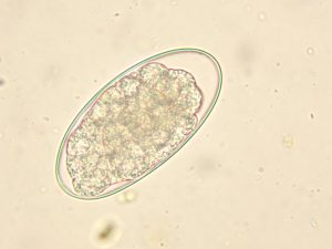 trichostrongylus