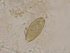 Uovo di capillaria